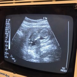 Anas Elias, MD - Best Care OBGYN - Ultrasound check up!
