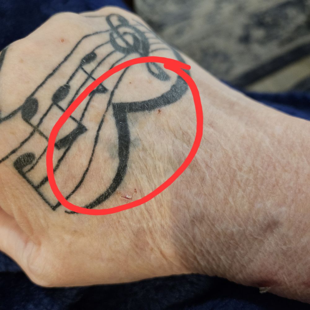 Cleopatra Ink - At first I thought this was bruising. Once it healed it's not, it's blow out. **disappointed!! - Tattoo Near Me - Chandler, Arizona Cleopatra Ink - At first I thought this was bruising. Once it healed it's not, it's blow out. **disappointed!! - Tattoo Near Me - Chandler, Arizona