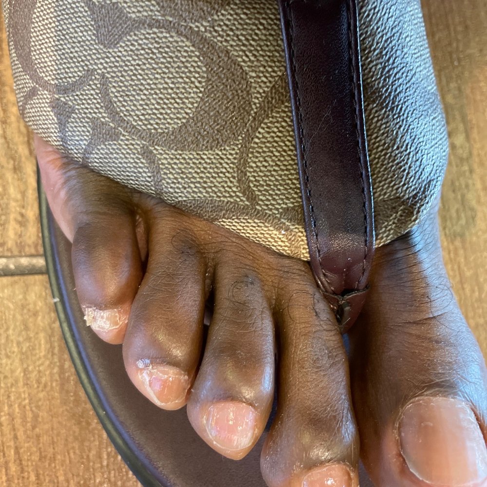 Horrible pedicure Horrible pedicure