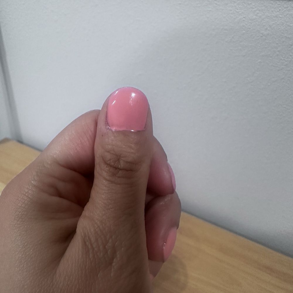 Cuticles flooded Cuticles flooded