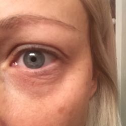 Luna Vision and Med Spa