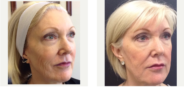 derma care rancho bernardo