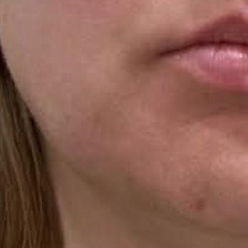 Austin Aesthetic Atelier - Medical Spas Near Me - Austin, Texas