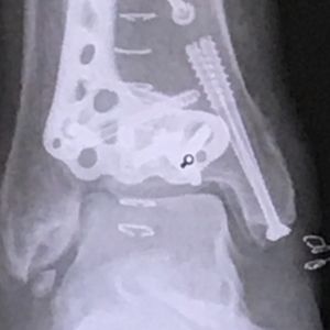 PANORAMA PHYSICAL THERAPY - Updated July 2024 - 21 Reviews - 660 Golden ...