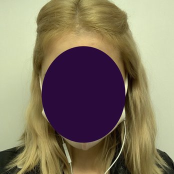Dosha - The purple photo is the AFTER. - Day Spas Near Me - Beaverton, Oregon Dosha - The purple photo is the AFTER. - Day Spas Near Me - Beaverton, Oregon