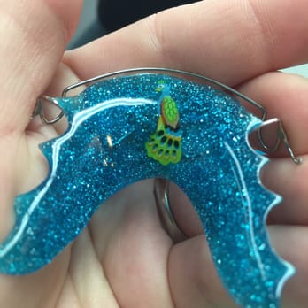 Long Beach Orthodontics - Very cool looking retainer. - Orthodontists Near Me - Long Beach, California