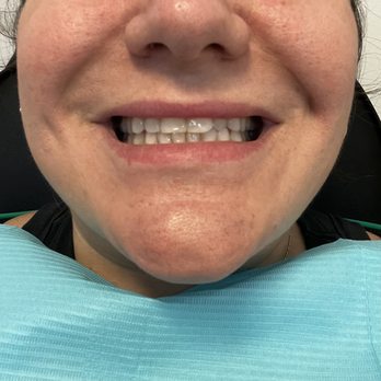 Magic Smile - Before - Cosmetic Dentists Near Me - New York, New York Magic Smile - Before - Cosmetic Dentists Near Me - New York, New York