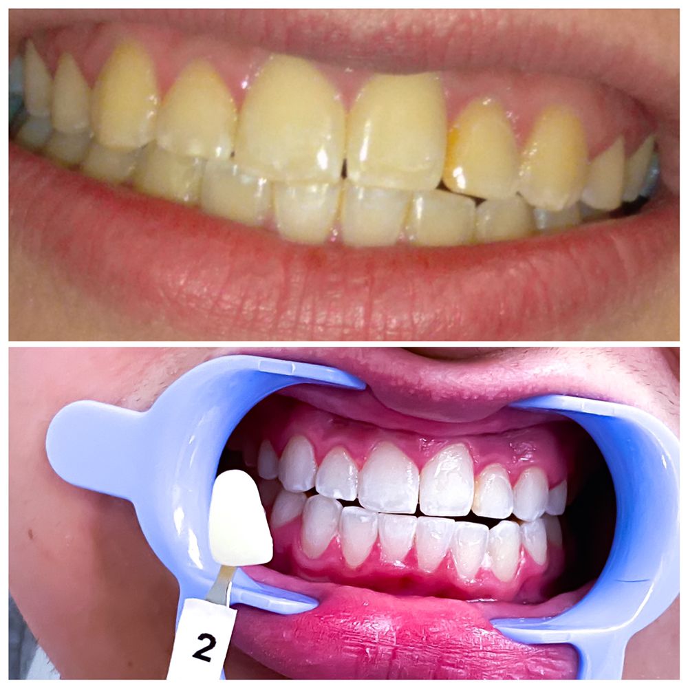 BEST TEETH WHITENING LAS VEGAS Updated September 2024 45 Photos