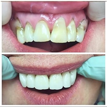 Indiana Emergency Dental - Bloomington - General Dentistry Near Me - Bloomington, Indiana Indiana Emergency Dental - Bloomington - General Dentistry Near Me - Bloomington, Indiana