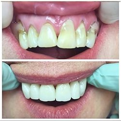 Indiana Emergency Dental - Bloomington