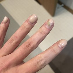 S&T Nails - Nail bacteria