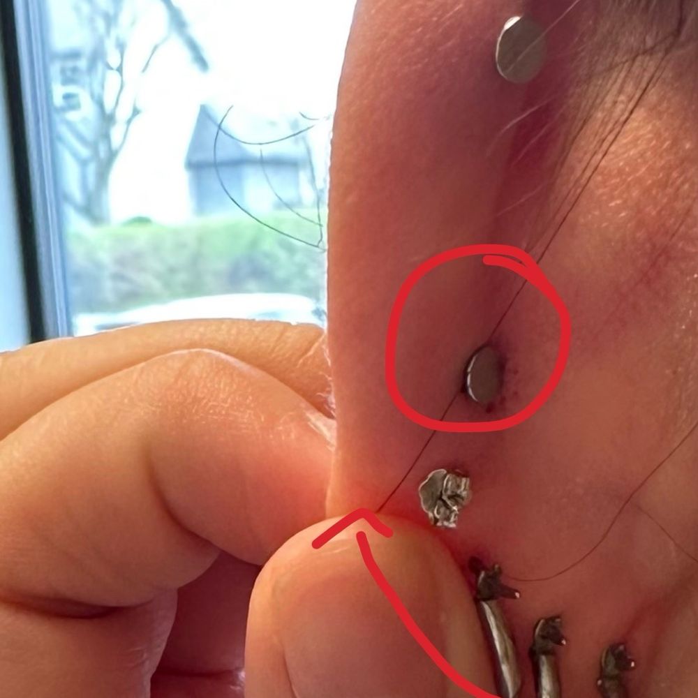 Circled one is the one I got done. All of my other ones are aligned going upwards but this one is misplaced.
