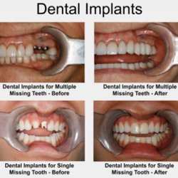 Diane Conly, DDS