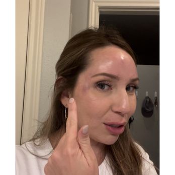 Eleven11 Laser + Skincare - Laser Hair Removal Near Me - Denver, Colorado Eleven11 Laser + Skincare - Laser Hair Removal Near Me - Denver, Colorado