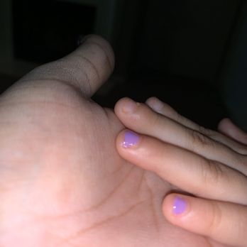 Gossip & Co. Nail Spa - My 5yr olds middle finger swollen & infected after a mani. - Nail Salons Near Me - Cypress, Texas Gossip & Co. Nail Spa - My 5yr olds middle finger swollen & infected after a mani. - Nail Salons Near Me - Cypress, Texas