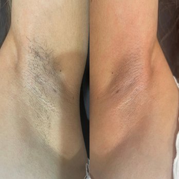 Bodied By Tiff - Before & After UnderArm - Waxing Near Me