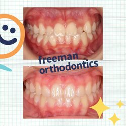 Freeman Orthodontics - Clear Aligners Treatment!