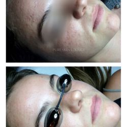 Pure Skin Lounge - At Pure Skin Lounge, we custom develop your skincare routine to resolve your skin problems.