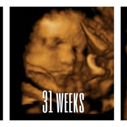 Meet Your Miracle - An example of an ultrasound at every week!