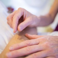 Acupuncture Anywhere