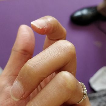 Deluxe Nails & Spa - Cut on finger from the mail machine, no apologies. look at all the residue and state of fingernails after buff...poor - Nail Salons Near Me - Midlothian, Virginia Deluxe Nails & Spa - Cut on finger from the mail machine, no apologies. look at all the residue and state of fingernails after buff...poor - Nail Salons Near Me - Midlothian, Virginia