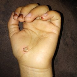 Rady Children's La Mesa Urgent Care - Took my 5yo dtr to urgent care 2 wks ago for hand scraped on ground catching freesbie. Dr didn't clean hand to take a look. Ggl helps more!