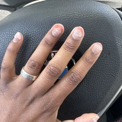 All nails are ripped and bleeding
