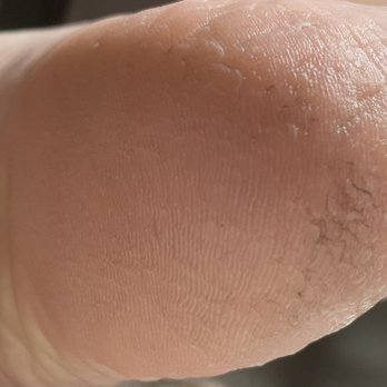 Cali Nails Hillside - Heals after returning home and being in the garden to water plants. See how dirt gets right into the skin! - Nail Salons Near Me - Victoria, British Columbia Cali Nails Hillside - Heals after returning home and being in the garden to water plants. See how dirt gets right into the skin! - Nail Salons Near Me - Victoria, British Columbia