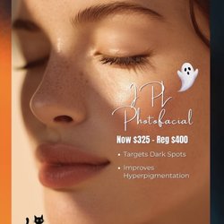 Zen Aesthetics and Wellness - IPL Photofacial Special