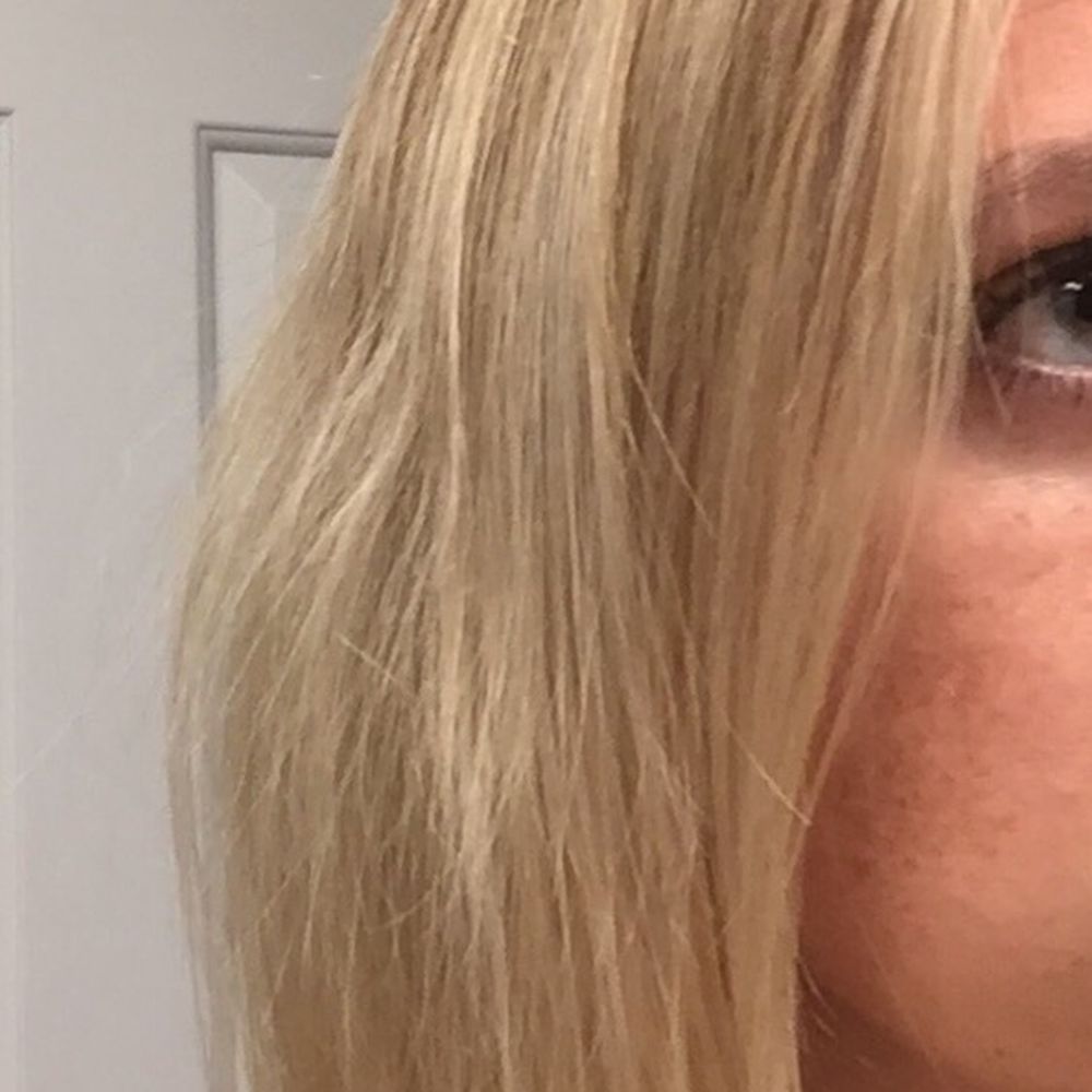 Salon Buzz - Towards the front of my face and on the side you can see additional breakage. - Day Spas Near Me - Chicago, Illinois