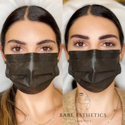 Bare Esthetics