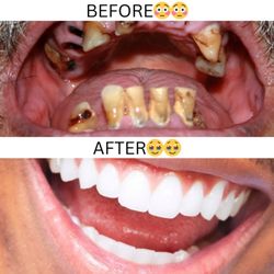 Aloha Dental Center - Had to do the before and after shot yo...