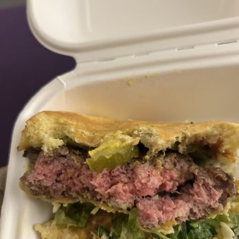 Al's Burger Shack - Under cooked burger. I pulled it in half so you can see that it's actually medium rare and not medium. There's a difference. - Burgers Near Me - Chapel Hill, North Carolina Al's Burger Shack - Under cooked burger. I pulled it in half so you can see that it's actually medium rare and not medium. There's a difference. - Burgers Near Me - Chapel Hill, North Carolina