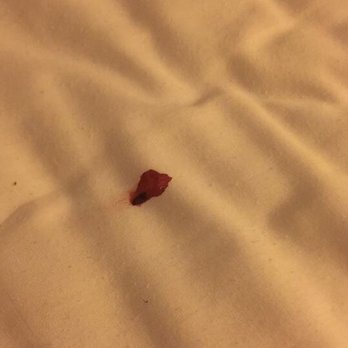 American Inn - Bed bugs - Hotels Near Me - Chico, California American Inn - Bed bugs - Hotels Near Me - Chico, California