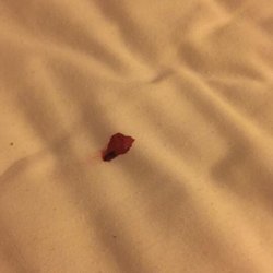 American Inn - Bed bugs