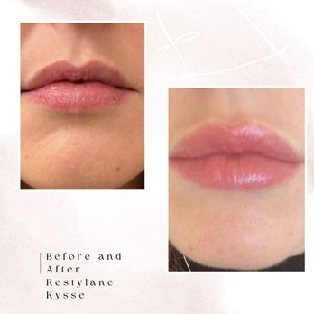 Beautiful Aesthetics - Skin Care Near Me - Tempe, Arizona Beautiful Aesthetics - Skin Care Near Me - Tempe, Arizona