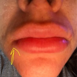 Allure Medical