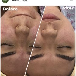 Nora Skin Spa - You deserve the best skin! With love Nora
