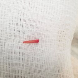 Feet First - Toothpick Removed