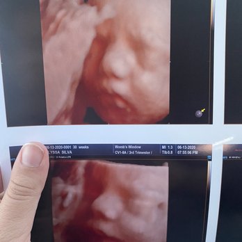Womb's View - Second daughter Haven - Ultrasound Imaging Centers Near Me - Modesto, California Womb's View - Second daughter Haven - Ultrasound Imaging Centers Near Me - Modesto, California