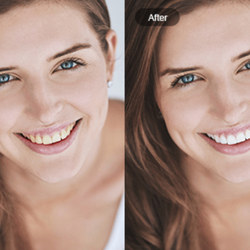 Radiant White Smiles of Austin