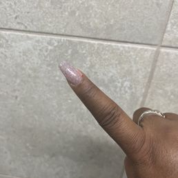 Bleeding cuticle Bleeding cuticle