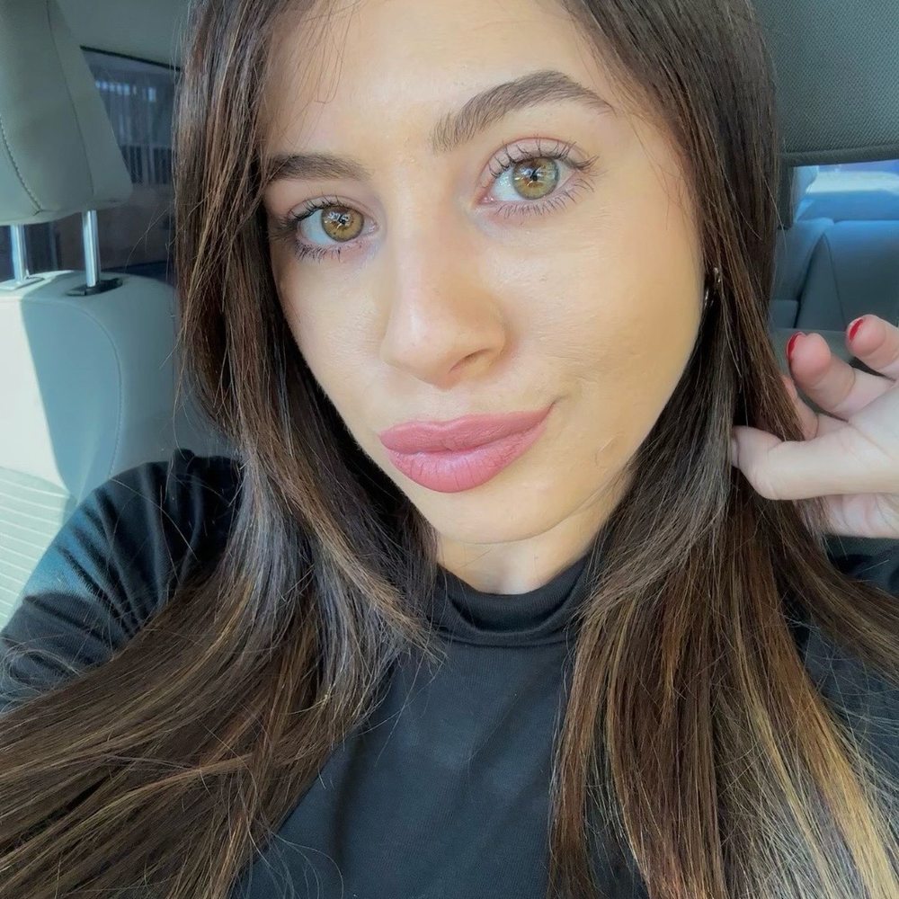 SlimmThicc - My skin after 1 treatment, morpheus 8 - Weight Loss Centers Near Me - San Diego, California SlimmThicc - My skin after 1 treatment, morpheus 8 - Weight Loss Centers Near Me - San Diego, California