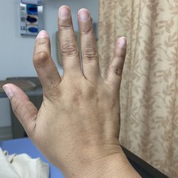 Redix Louis C Jr MD - Before my surgery