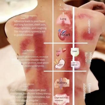 Heavenly spa - The acupoint is clearly marked with the reflex zone. - Massage Near Me - San Diego, California Heavenly spa - The acupoint is clearly marked with the reflex zone. - Massage Near Me - San Diego, California