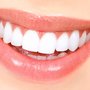 Photo of Premier Braces