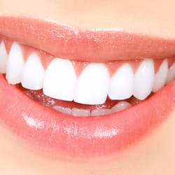 Premier Braces