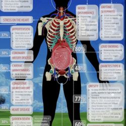 Next Gen Sleep - The Consequences of Obstructive sleep apnea