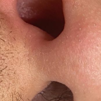 The Fuzzy Peach - Nose Wax - Waxing Near Me - Rancho Cucamonga , California The Fuzzy Peach - Nose Wax - Waxing Near Me - Rancho Cucamonga , California