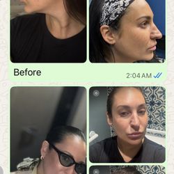 Aristocrat Plastic Surgery & MedAesthetics - Contour neck lift